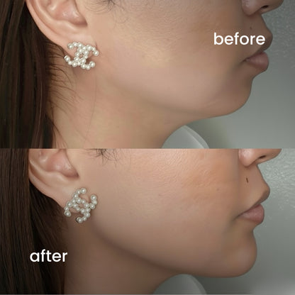 SkinEva Face Belt